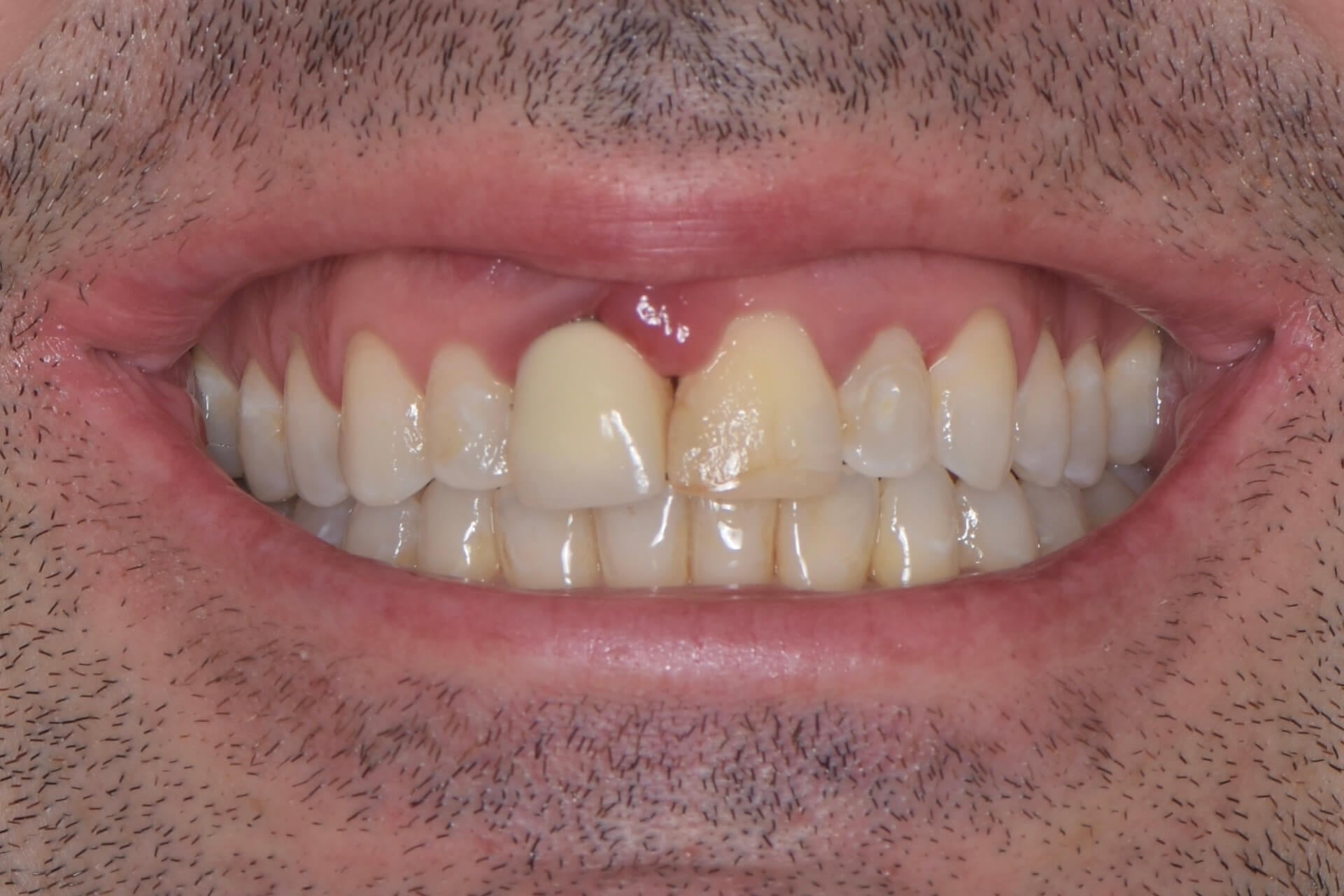 Emergency Dental Care — before
